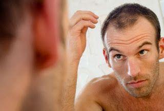 The bald truth: 10 reasons why you are losing your hair - Arabian Business