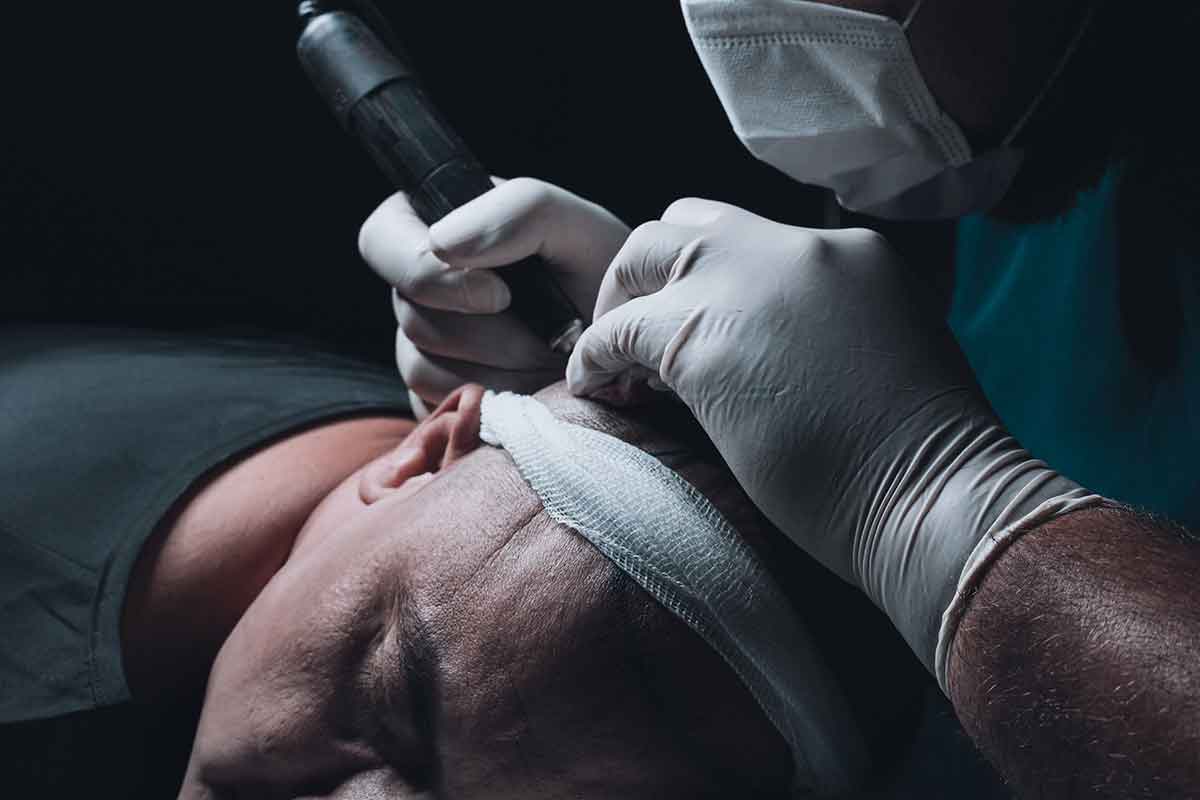 Hair loss, robot transplants: Inside the multi-billion dollar industry battling baldness
