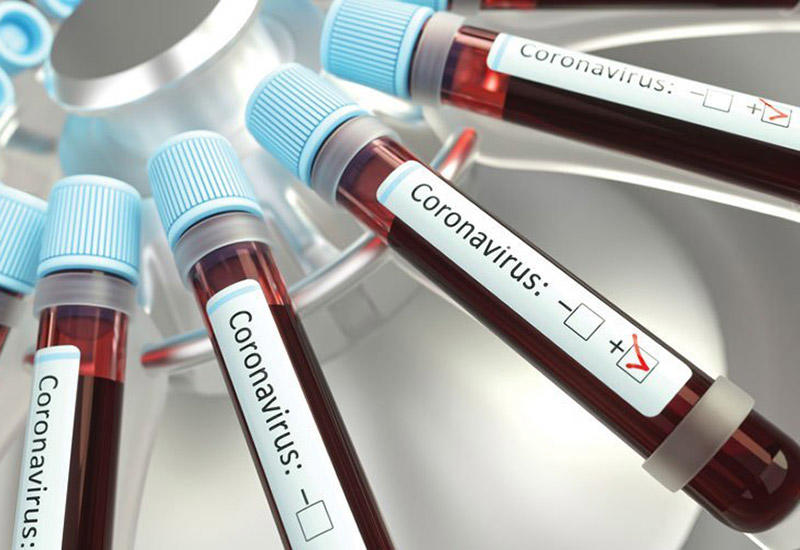 Coronavirus: Kuwait reports 885 new cases, eight more deaths