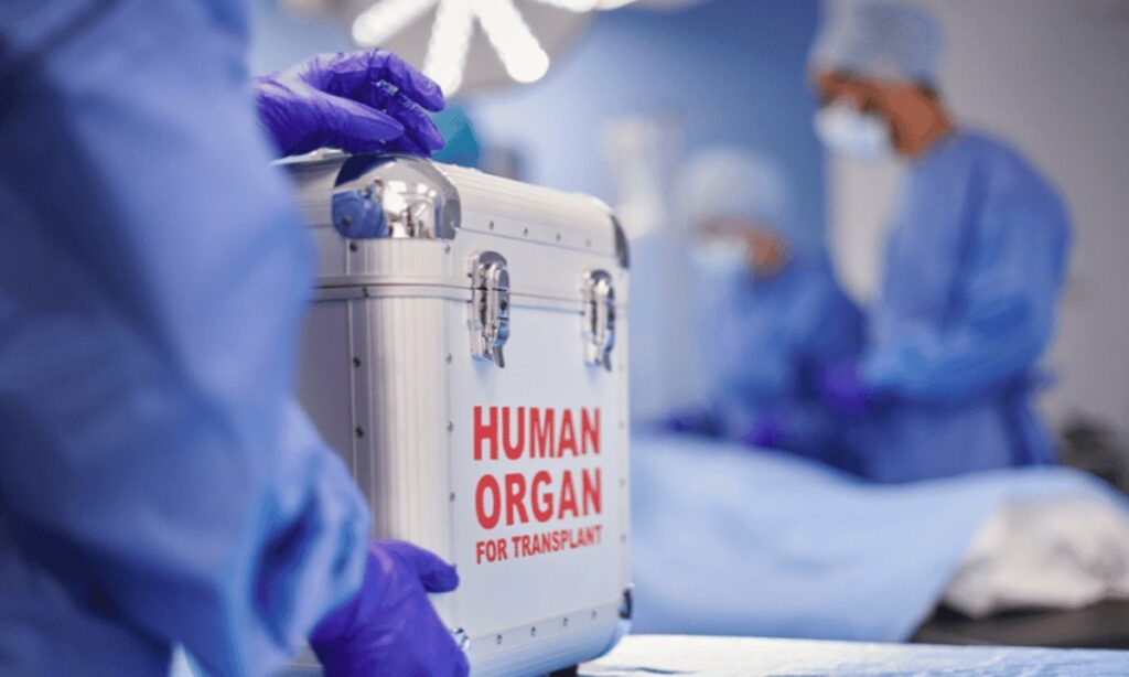 organ transplants
